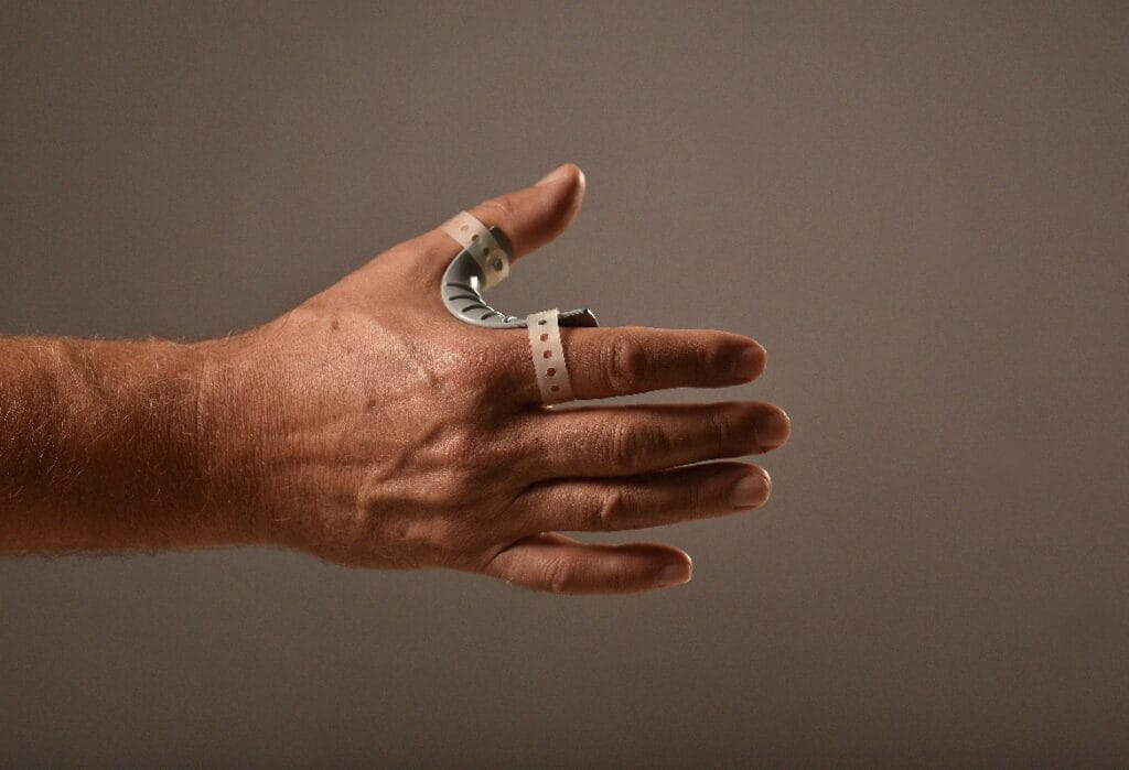 Eine Hand mit heller Hautfarbe, die eine gebogene, graue Prothese trägt, die an Daumen und Zeigefinger befestigt ist.