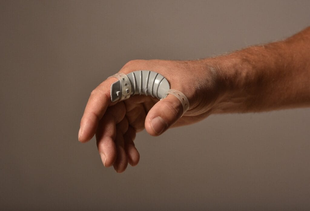 Eine Hand mit einer grauen Roboterprothese, die an Daumen und Handgelenk befestigt ist, wird vor einem unifarbenen Hintergrund gezeigt.