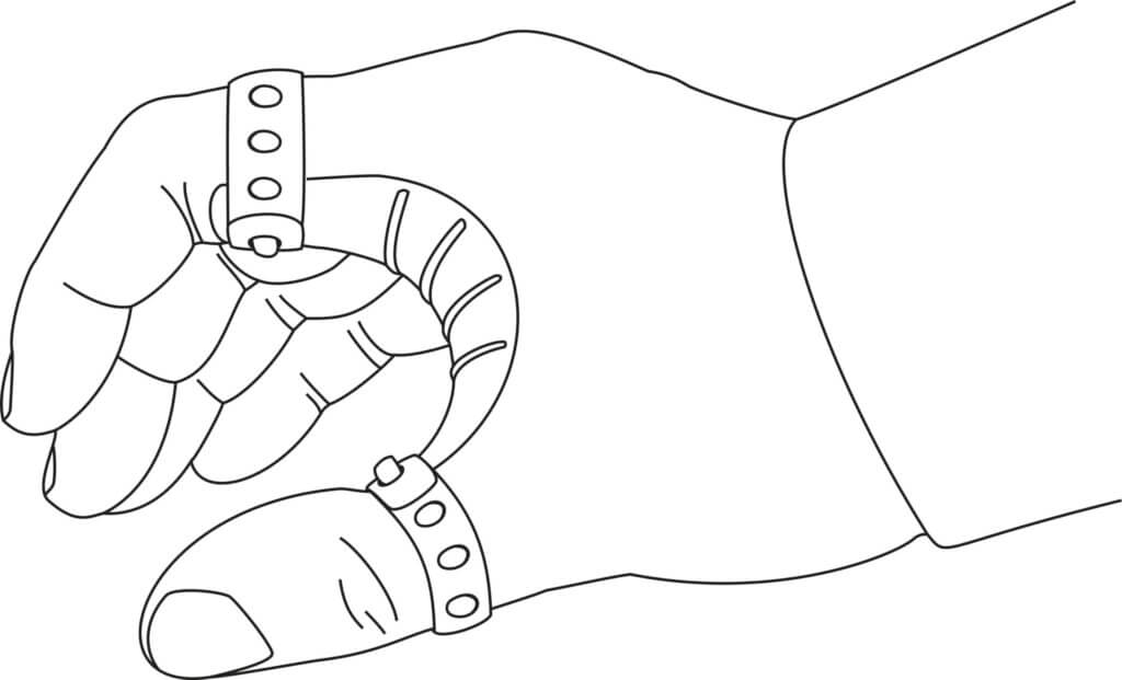 Strichzeichnung einer Hand, die eine medizinische Schiene oder Orthese um Daumen und Finger trägt, die die Hand in einer teilweise geschlossenen Position hält.